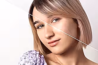 Cildin bir yarısı lekeli, diğer yarısı ise tedavi sonrası pürüzsüz olan kadın.